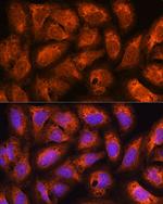 ACAP2 Antibody in Immunocytochemistry (ICC/IF)