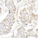 AMID Antibody in Immunohistochemistry (Paraffin) (IHC (P))