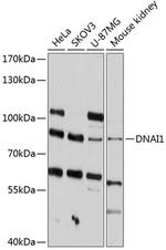 DNAI1 Antibody in Western Blot (WB)