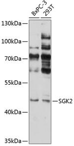 SGK2 Antibody in Western Blot (WB)