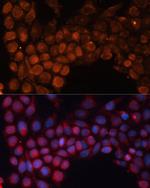 SLC25A24 Antibody in Immunocytochemistry (ICC/IF)