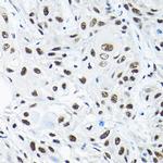 SNRPA1 Antibody in Immunohistochemistry (Paraffin) (IHC (P))