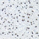 SNRPA1 Antibody in Immunohistochemistry (Paraffin) (IHC (P))