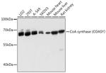 CoA Synthase Antibody in Western Blot (WB)