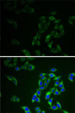 Adenylate Kinase 1 Antibody in Immunocytochemistry (ICC/IF)