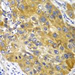 Adenylate Kinase 1 Antibody in Immunohistochemistry (Paraffin) (IHC (P))