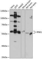 IP6K1 Antibody in Western Blot (WB)