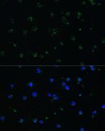 ARHGAP25 Antibody in Immunocytochemistry (ICC/IF)