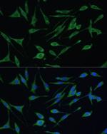 ARHGAP25 Antibody in Immunocytochemistry (ICC/IF)