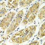 ARHGAP25 Antibody in Immunohistochemistry (Paraffin) (IHC (P))