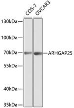 ARHGAP25 Antibody in Western Blot (WB)