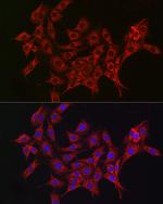 ALDH2 Antibody in Immunocytochemistry (ICC/IF)