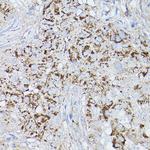 ALDH2 Antibody in Immunohistochemistry (Paraffin) (IHC (P))