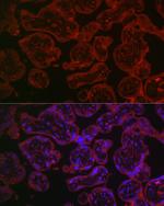 CD55 Antibody in Immunohistochemistry (Paraffin) (IHC (P))