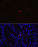 NTS Antibody in Immunohistochemistry (Paraffin) (IHC (P))