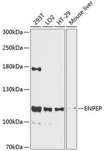 CD249 Antibody in Western Blot (WB)