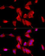 NSE Antibody in Immunocytochemistry (ICC/IF)