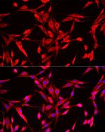 NSE Antibody in Immunocytochemistry (ICC/IF)