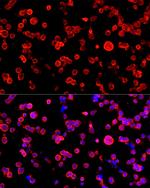 NSE Antibody in Immunocytochemistry (ICC/IF)