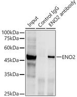 NSE Antibody in Immunoprecipitation (IP)