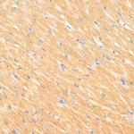 MYBPC3 Antibody in Immunohistochemistry (Paraffin) (IHC (P))