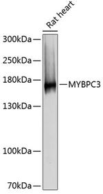 MYBPC3 Antibody in Western Blot (WB)