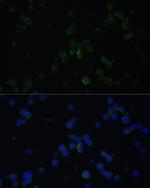 CD3d Antibody in Immunocytochemistry (ICC/IF)