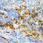 CD3d Antibody in Immunohistochemistry (Paraffin) (IHC (P))