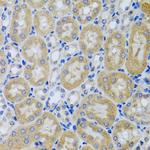 Acid Phosphatase 1 Antibody in Immunohistochemistry (Paraffin) (IHC (P))