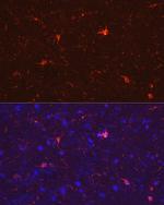 IBA1 Antibody in Immunocytochemistry (ICC/IF)