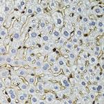 Annexin A2 Antibody in Immunohistochemistry (Paraffin) (IHC (P))