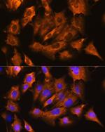 ATP1B1 Antibody in Immunocytochemistry (ICC/IF)