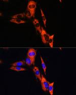 ATP1B1 Antibody in Immunocytochemistry (ICC/IF)