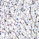 beta-2 Microglobulin Antibody in Immunohistochemistry (Paraffin) (IHC (P))