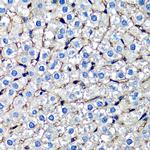 beta-2 Microglobulin Antibody in Immunohistochemistry (Paraffin) (IHC (P))