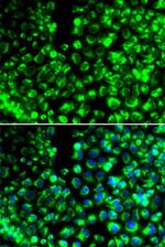 Calumenin Antibody in Immunocytochemistry (ICC/IF)