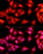 Ataxin 3 Antibody in Immunocytochemistry (ICC/IF)