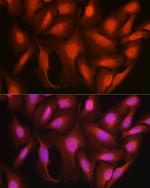 Ataxin 3 Antibody in Immunocytochemistry (ICC/IF)