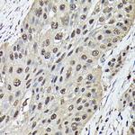 Ataxin 3 Antibody in Immunohistochemistry (Paraffin) (IHC (P))