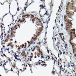 Ataxin 3 Antibody in Immunohistochemistry (Paraffin) (IHC (P))