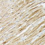 PSMA3 Antibody in Immunohistochemistry (Paraffin) (IHC (P))