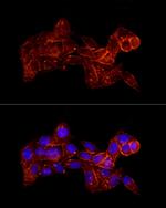 Moesin Antibody in Immunocytochemistry (ICC/IF)