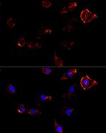 Moesin Antibody in Immunocytochemistry (ICC/IF)