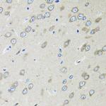 OGDH Antibody in Immunohistochemistry (Paraffin) (IHC (P))