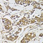 PIK3CA Antibody in Immunohistochemistry (Paraffin) (IHC (P))