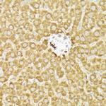 PIK3CA Antibody in Immunohistochemistry (Paraffin) (IHC (P))