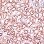 SHMT1 Antibody in Immunohistochemistry (Paraffin) (IHC (P))