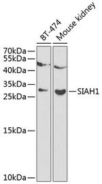 SIAH1 Antibody in Western Blot (WB)