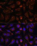 AKT2 Antibody in Immunocytochemistry (ICC/IF)