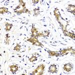 AKT2 Antibody in Immunohistochemistry (Paraffin) (IHC (P))